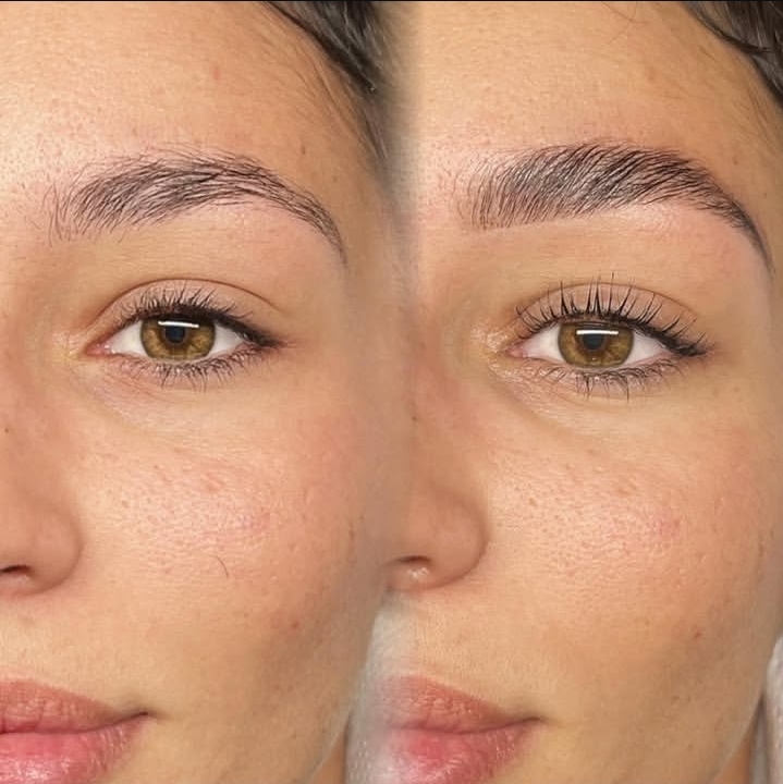 Client transformation